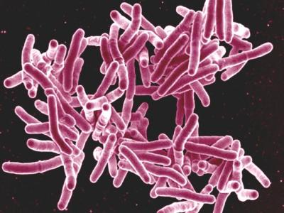 How tuberculosis evades our immune response