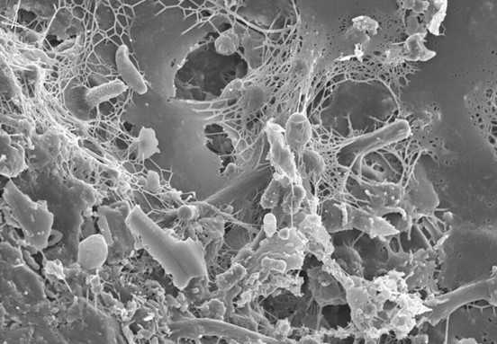 Vibrio cholerae hunts immune cells using biofilm.