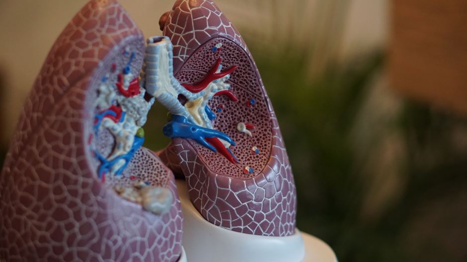 How the Microbiome Determines Preterm Lung Health