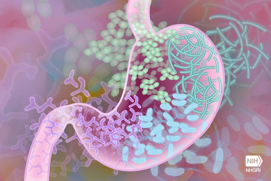 Diabetic connections lie in our gut