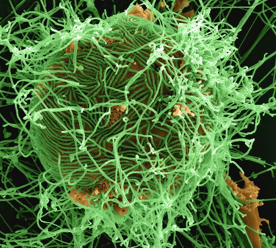 Ebola Virus Sneaks Out Through Cellular Tunnels